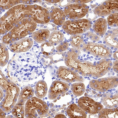 ALDH1L1 Recombinant Rabbit mAb (S-2885-49)