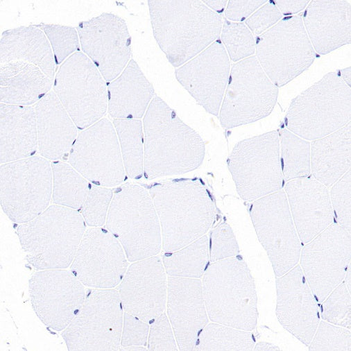 eNOS Recombinant Rabbit mAb (S-1885-94)