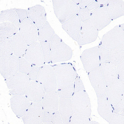 eNOS Recombinant Rabbit mAb (S-1885-94)