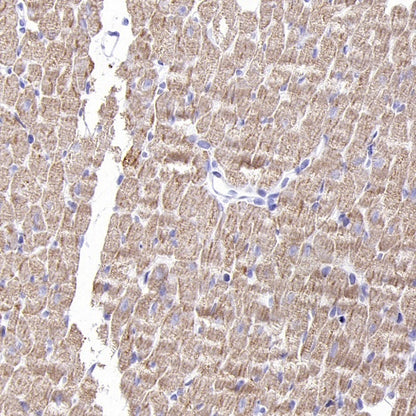 VDAC1 + VDAC2 + VDAC3 Rabbit Polyclonal Antibody
