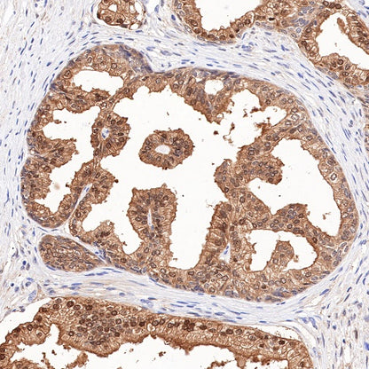 IDH1 Recombinant Rabbit mAb (S-792-16)