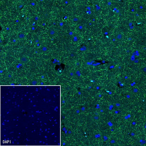 Caspr Recombinant Rabbit mAb (S-1706-1)
