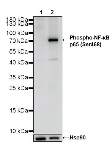 Phospho-NF-κB p65 (Ser468) Recombinant Rabbit mAb (S-1124-133)