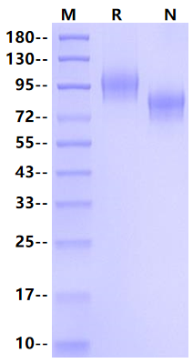 E-Selectin/CD62E His Tag Protein, Cynomolgus