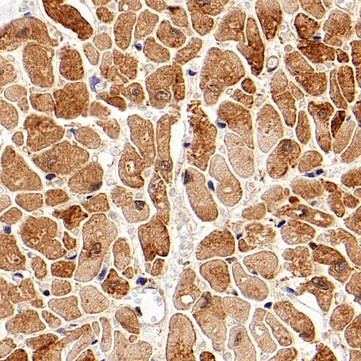 BAG3 Recombinant Rabbit mAb (S-1837-22)