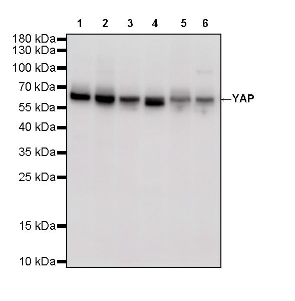 YAP Recombinant Rabbit mAb (S-3921-42)