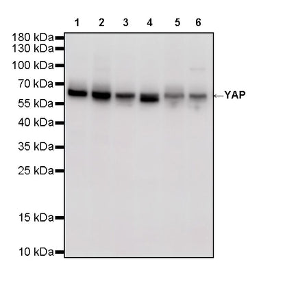 YAP Recombinant Rabbit mAb (S-3921-42)
