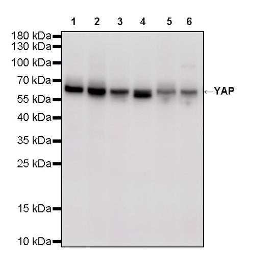YAP Recombinant Rabbit mAb (S-3921-42)