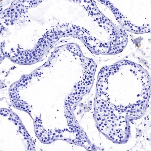 Claudin 6 Recombinant Rabbit mAb (S-521-63)