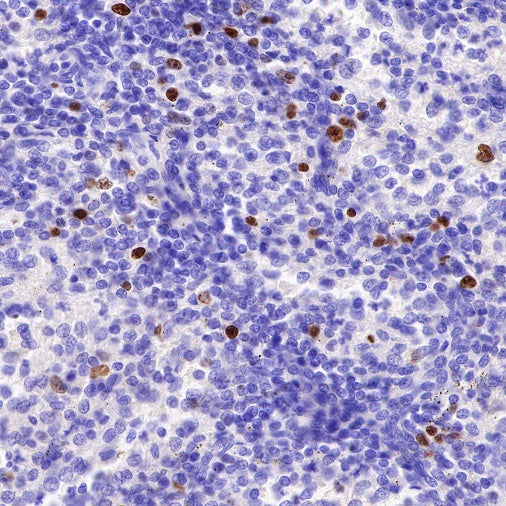 Ki67 Mouse mAb (SDT-606-33)