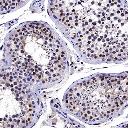 ERCC1 Recombinant Rabbit mAb (SDT-2458-29)