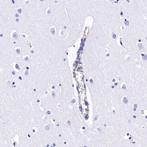 Integrin alpha 5 Recombinant Rabbit mAb (S-381-37)
