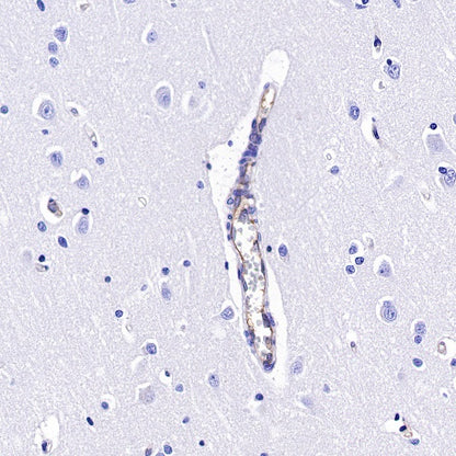 Integrin alpha 5 Recombinant Rabbit mAb (S-381-37)