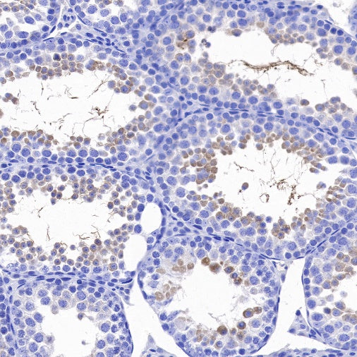 LKB1 Recombinant Rabbit mAb (S-1264-31)