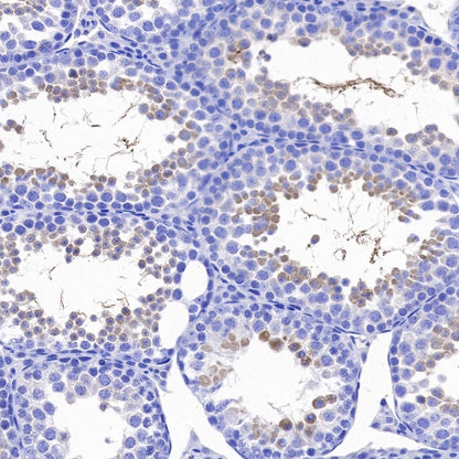 LKB1 Recombinant Rabbit mAb (S-1264-31)