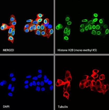 Histone H2B (mono methyl K5) Recombinant Rabbit mAb (S-1416-412)