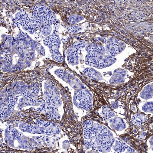 B7-H3 Recombinant Rabbit mAb (SDT-1333-8)