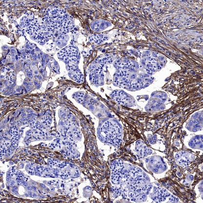 B7-H3 Recombinant Rabbit mAb (SDT-1333-8)