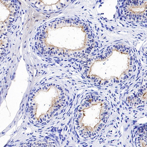 GPR64 Recombinant Rabbit mAb (S-1919-10)