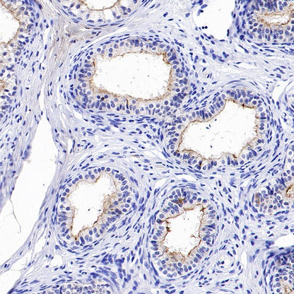 GPR64 Recombinant Rabbit mAb (S-1919-10)