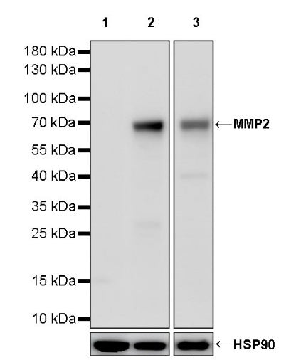 MMP2 Recombinant Rabbit mAb (S-1804-55)