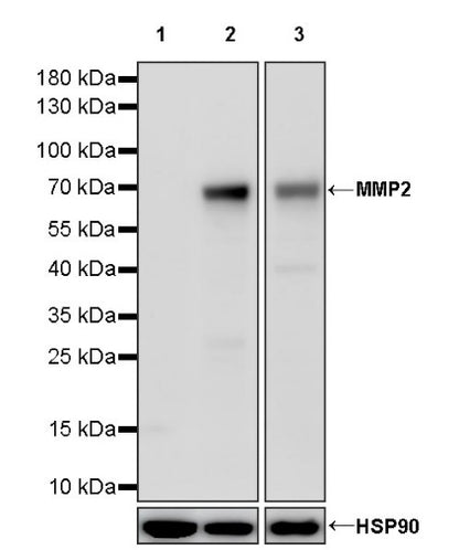MMP2 Recombinant Rabbit mAb (S-1804-55)