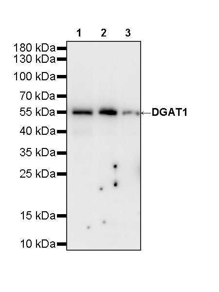 DGAT1 Recombinant Rabbit mAb (S-4623-9)
