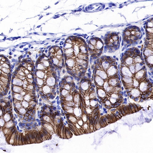 E-Cadherin Recombinant Rabbit mAb (SDT-438-45)