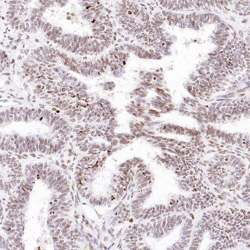 Histone H3 (acetyl K4) Recombinant Rabbit mAb (S-848-137)