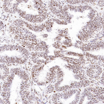 Histone H3 (acetyl K4) Recombinant Rabbit mAb (S-848-137)
