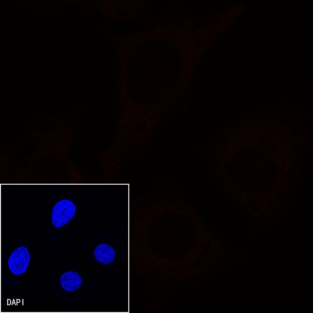 CD38 Recombinant Rabbit mAb (Alexa Fluor® 594 Conjugate) (S-031-45-2)