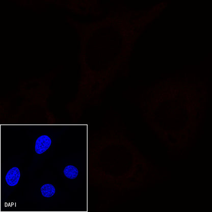 CD38 Recombinant Rabbit mAb (Alexa Fluor® 594 Conjugate) (S-031-45-2)