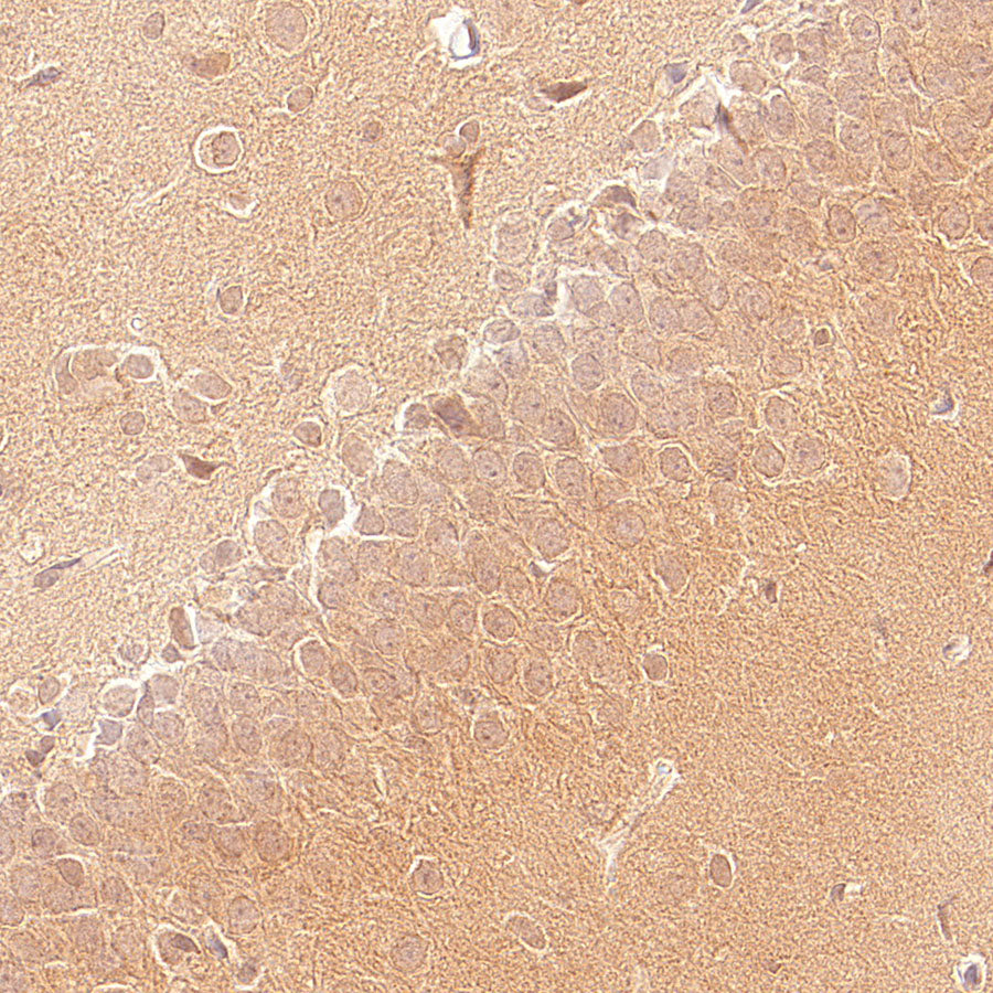 GABA A Receptor alpha 5/GABRA5 Recombinant Rabbit mAb (S-6030)