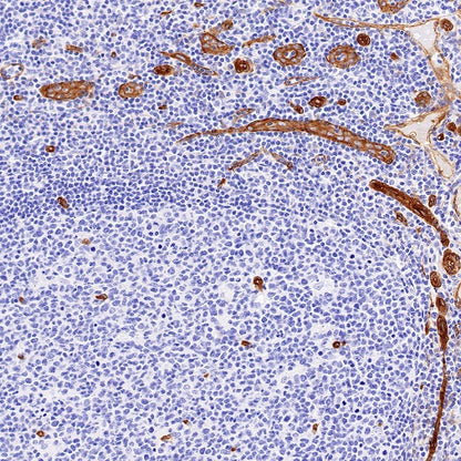 EHD2 Recombinant Rabbit mAb (S-1580-60)