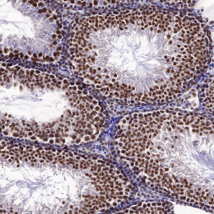 EWSR1/EWS Recombinant Rat mAb (S-R201)