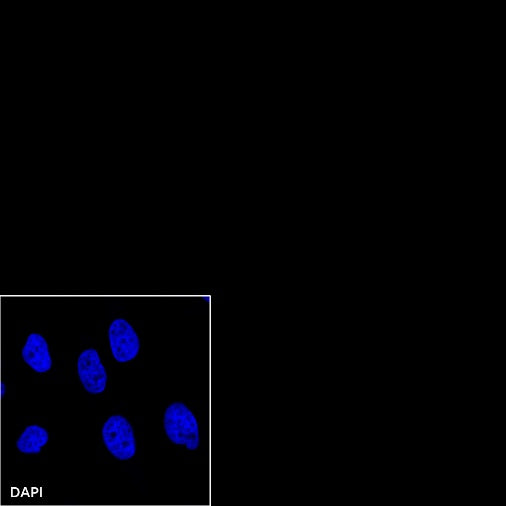 Rabbit mAb IgG Isotype Control (SDT-R173)