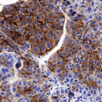 Claudin 6 Recombinant Rabbit mAb (S-521-63)