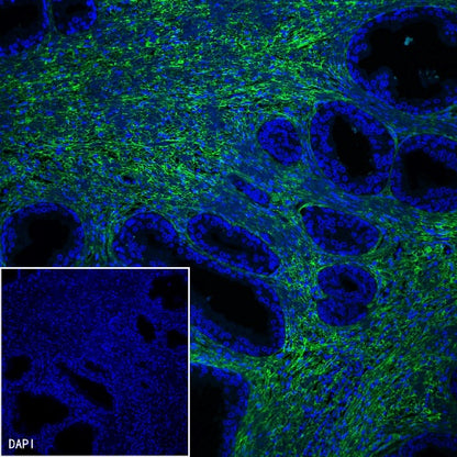 Collagen VI (COL6A1) Recombinant Rabbit mAb (S-1495-18)