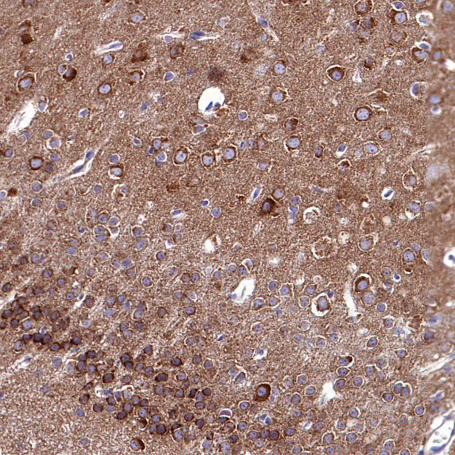 RPS3 Recombinant Rabbit mAb (S-4121-27)