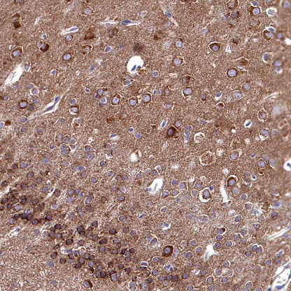 RPS3 Recombinant Rabbit mAb (S-4121-27)