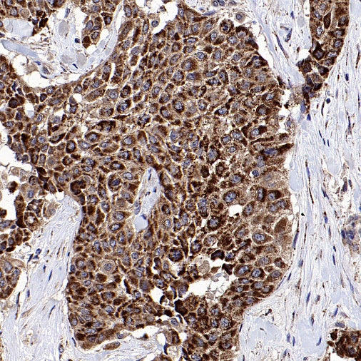 PYCR1 Rabbit Polyclonal Antibody