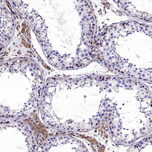 KL Recombinant Rabbit mAb (S-2245-169)