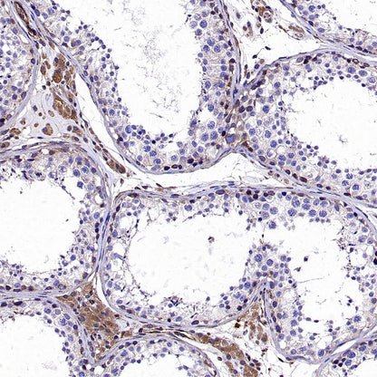 KL Recombinant Rabbit mAb (S-2245-169)