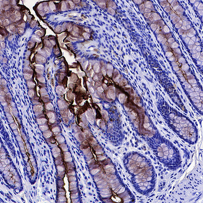 CEA Recombinant Rabbit mAb (SDT-098-41)