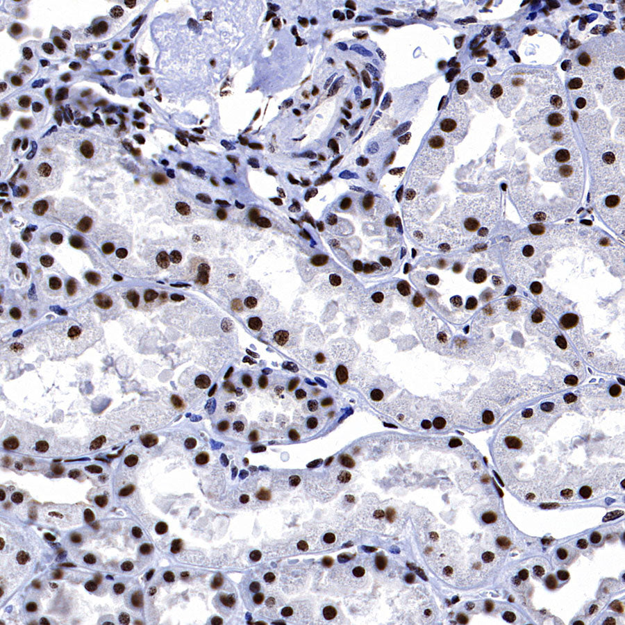 EIF4A3 Mouse mAb