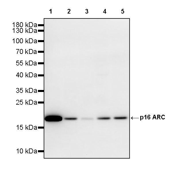 ARPC5/p16 ARC Recombinant Rabbit mAb (S-3564-23)