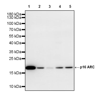ARPC5/p16 ARC Recombinant Rabbit mAb (S-3564-23)