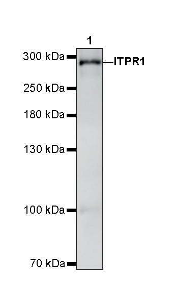 ITPR1 Recombinant Rabbit mAb (S-4530-5)