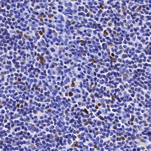 S-RMab® PU.1 Recombinant Rabbit mAb (SDT-R236)