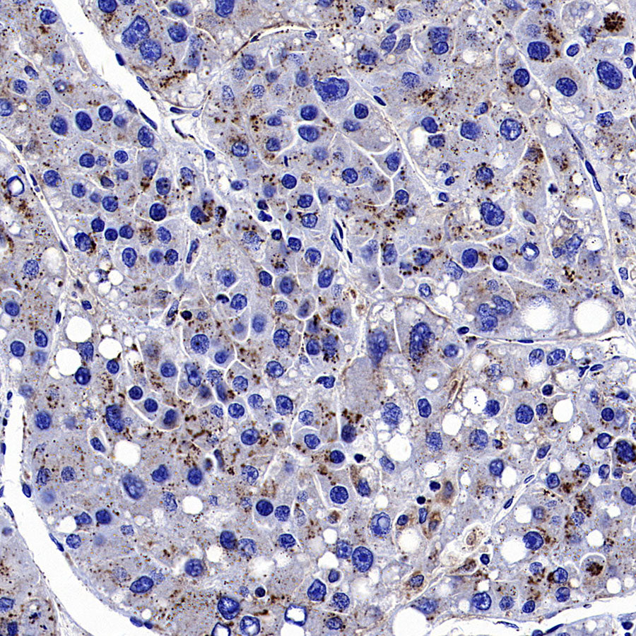 Galactosylceramidase Recombinant Rabbit mAb (S-3402-17)